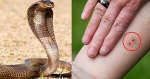 किशोर समेत दो को सर्प ने डसा