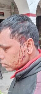 भाजपा नेता के भाई को बदमाशो ने कट्टे की बट और सरिया से मारकर किया लहुलुहान