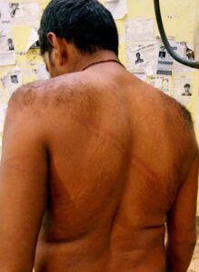 FIR दर्ज कराने के लिए पीड़ित  बैठेगा अनशन पर